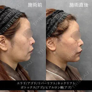 RIVER CLINIC（リバークリニック）大阪院の症例