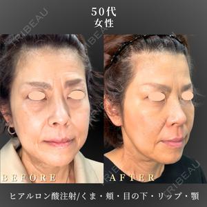BiBiクリニック 山本 幸一郎医師の症例