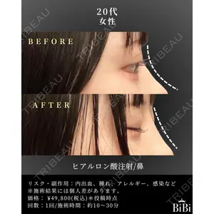BiBiクリニック 山本 幸一郎医師の症例