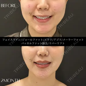 RIVER CLINIC（リバークリニック）の症例