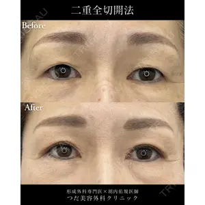 つだ美容外科クリニック 胡内 佑規医師の症例