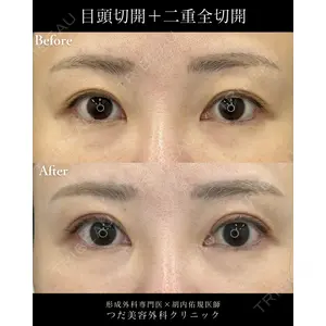 つだ美容外科クリニック 胡内 佑規医師の症例