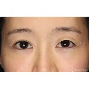 聖心美容クリニック 大宮院 伊藤 哲郎医師の症例