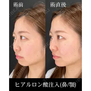 HAAB×DREAM BEAUTY CLINIC 大阪梅田院 柏木 太雅医師の症例