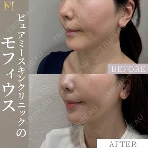 PureMe Skin Clinic（ピュアミースキンクリニック麻布） 福田 麻衣医師の症例