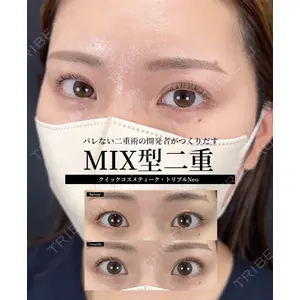 湘南美容クリニック 大阪梅田本院 横谷 仁彦医師の症例