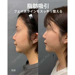 春山記念病院 山田 浩之医師の症例