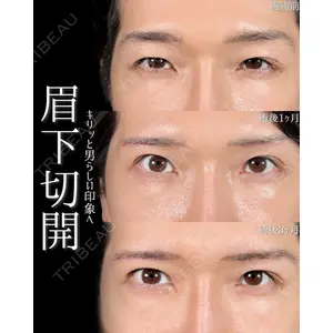 新宿美容外科ネビュラクリニック 山本 紘子医師の症例