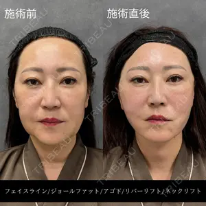 RIVER CLINIC（リバークリニック）大阪院の症例