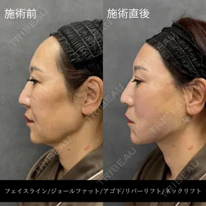 RIVER CLINIC（リバークリニック）大阪院の症例