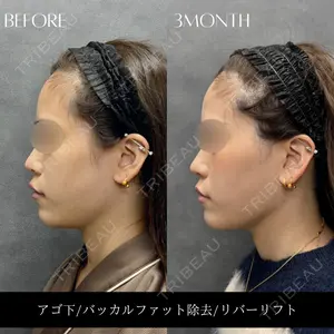 RIVER CLINIC（リバークリニック）大阪院の症例