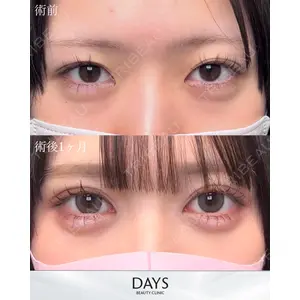Days Beauty Clinic 新宿院の症例