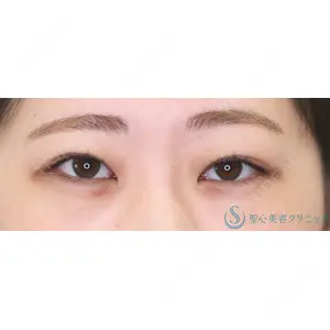 聖心美容クリニック 福岡院 美原 寿之医師の症例