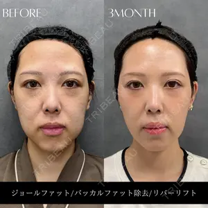 RIVER CLINIC（リバークリニック）大阪院 木家 佑理子医師の症例