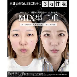 湘南美容クリニック 大阪梅田本院 横谷 仁彦医師の症例