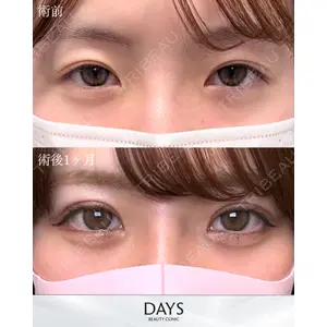 Days Beauty Clinic 新宿院の症例