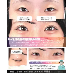 湘南美容クリニック 大阪梅田本院 横谷 仁彦医師の症例