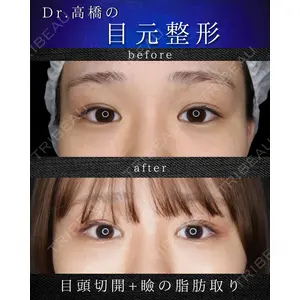 千葉美容外科アイビークリニック 高橋 京佑 医師の症例