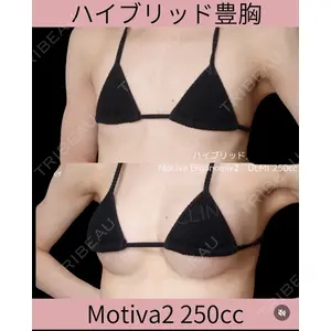 千葉美容外科アイビークリニックの症例