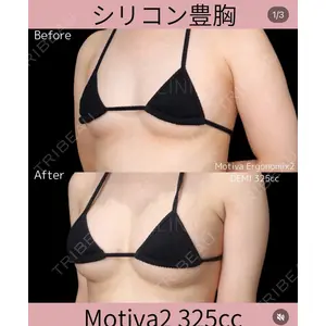 千葉美容外科アイビークリニックの症例