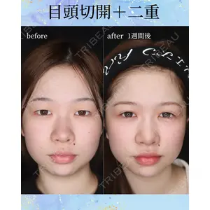 千葉美容外科アイビークリニック 藤田 愛樹医師の症例
