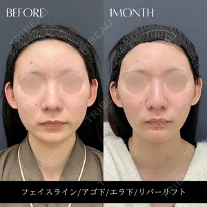 RIVER CLINIC（リバークリニック）の症例