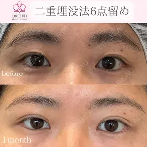 オーキッド美容クリニック東京御徒町 西浦 蘭子医師の症例