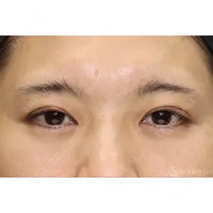 聖心美容クリニック 六本木院 綾部 奈々子医師の症例