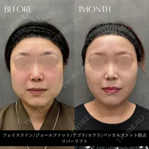 RIVER CLINIC（リバークリニック）大阪院の症例