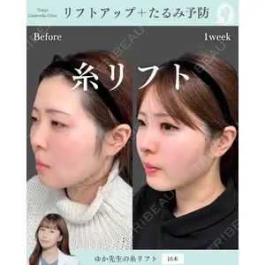 東京シンデレラ美容外科 新宿院 宮﨑友伽医師の症例