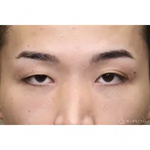 聖心美容クリニック 六本木院 綾部 奈々子医師の症例