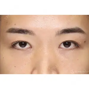 聖心美容クリニック 六本木院 綾部 奈々子医師の症例