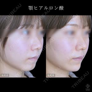 藤・ナチュレ美容クリニック 銀座院 小川 杏平医師の症例