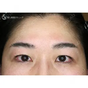 聖心美容クリニック 札幌院 前多 一彦医師の症例