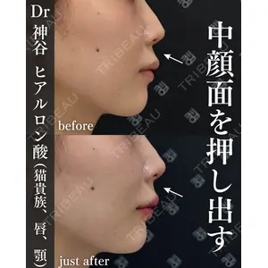 EMMO FACE CLINIC 大阪梅田院 神谷 一成医師の症例
