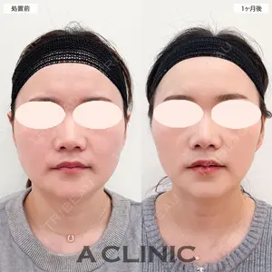 A CLINIC（エークリニック） 大阪院の症例
