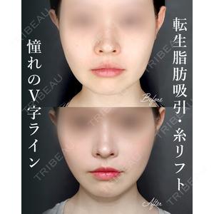 Tokyo Tensei Clinic 新宿院の症例