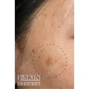 Jスキンクリニック 【J-SKIN clinic】 牧野　潤医師の症例