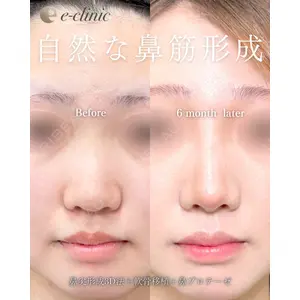 eクリニック 福岡院 伊藤 渉医師の症例