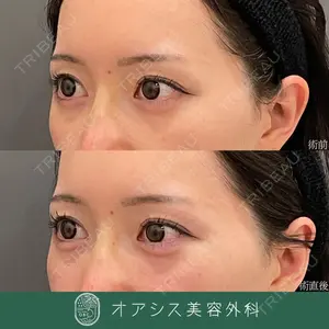 オアシス美容外科 遠藤 剛史医師の症例
