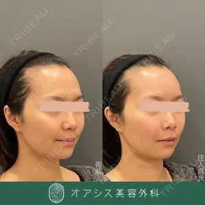 オアシス美容外科 遠藤 剛史医師の症例