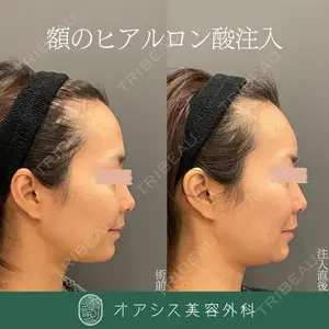 オアシス美容外科 遠藤 剛史医師の症例