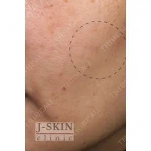 Jスキンクリニック 【J-SKIN clinic】 牧野　潤医師の症例