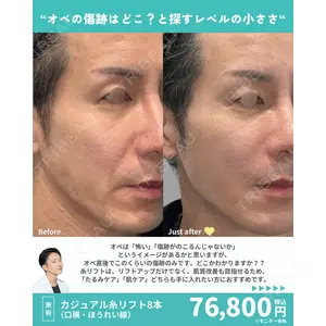 カジュアルクリニック 平塚院 中田 征希医師の症例