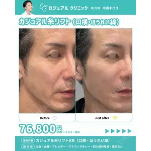 カジュアルクリニック 平塚院 中田 征希医師の症例