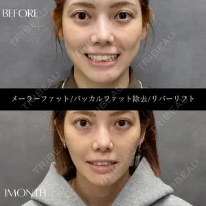 RIVER CLINIC（リバークリニック）大阪院の症例