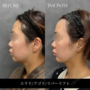 RIVER CLINIC（リバークリニック）大阪院の症例