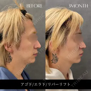 RIVER CLINIC（リバークリニック）大阪院の症例