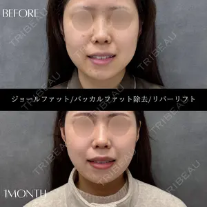 RIVER CLINIC（リバークリニック）大阪院の症例