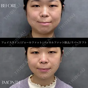 RIVER CLINIC（リバークリニック）大阪院の症例